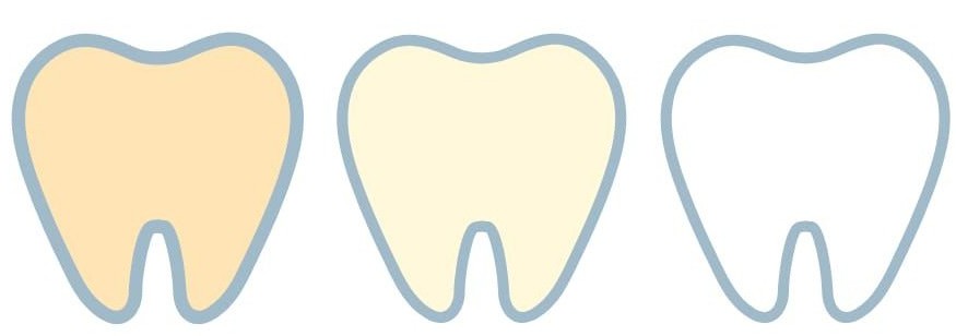 Tratamento estético indicado para restaurar a cor original do dente, eliminando pigmentações e tornando-os mais brancos.
