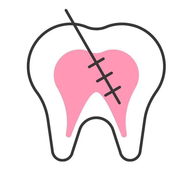 Endodontia: Tratamento de doenças que afetam a polpa dentária, também conhecido como tratamento de canal.