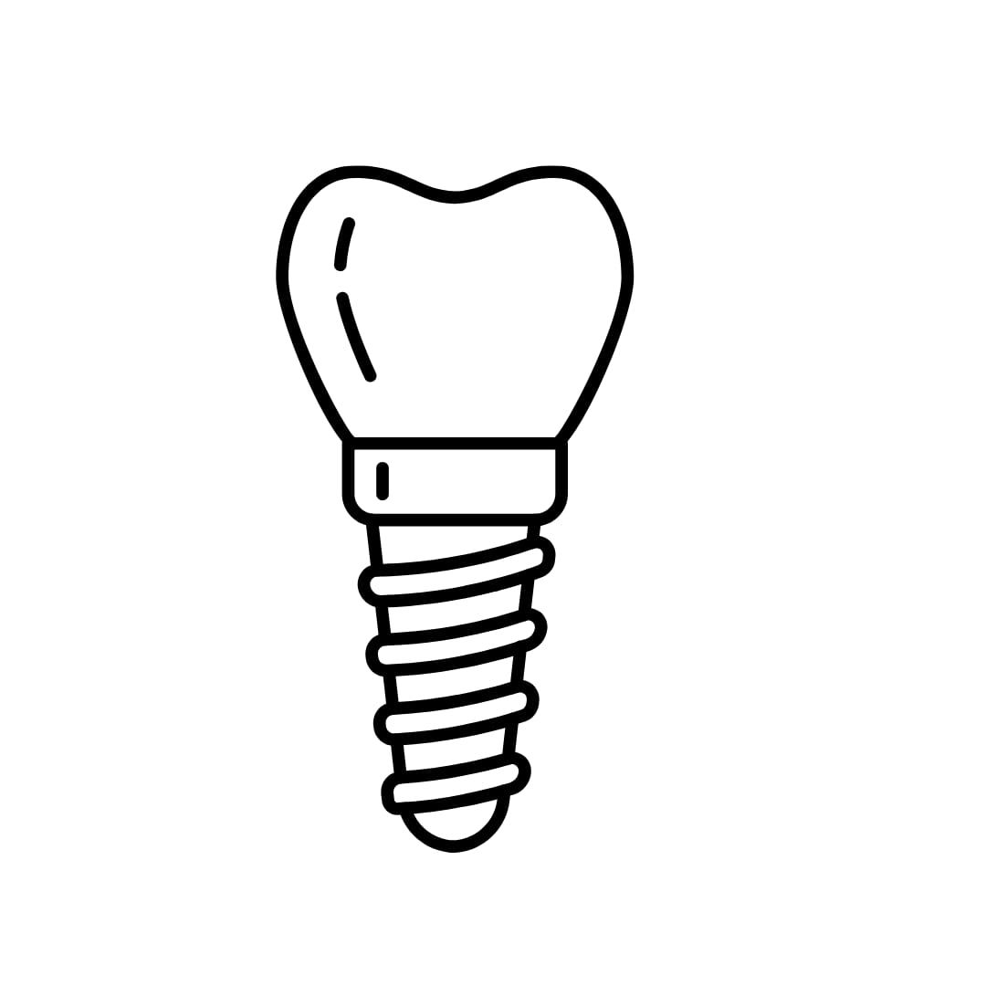 Implantes: Procedimento para a substituição de um ou mais dentes perdidos, solução estável e duradoura.